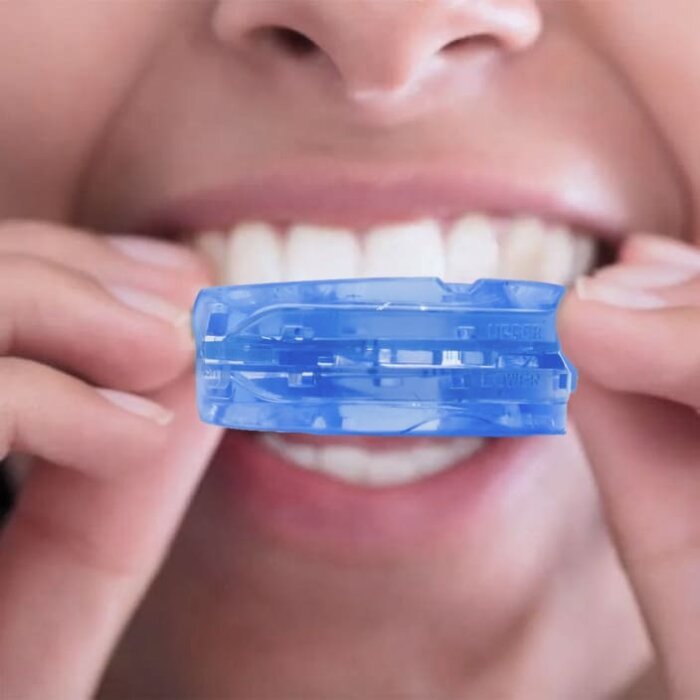 Mandibular Advancement Device image
